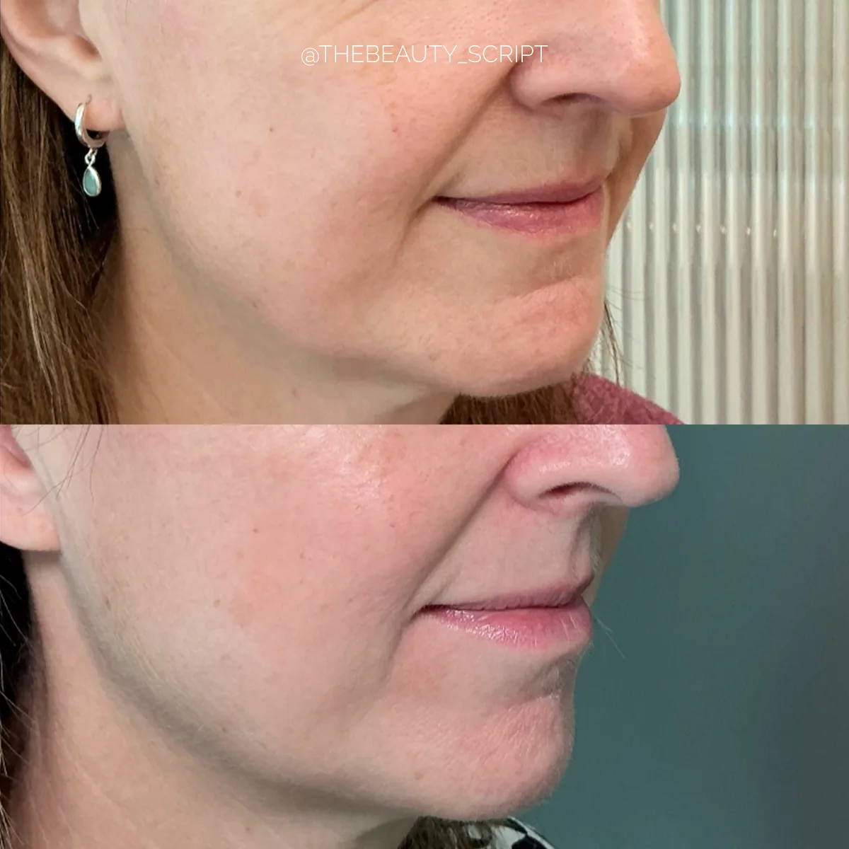 Before and after