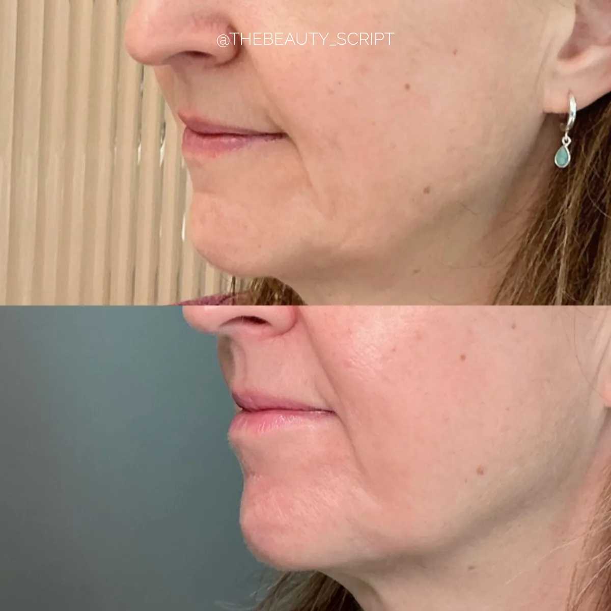 Before and after