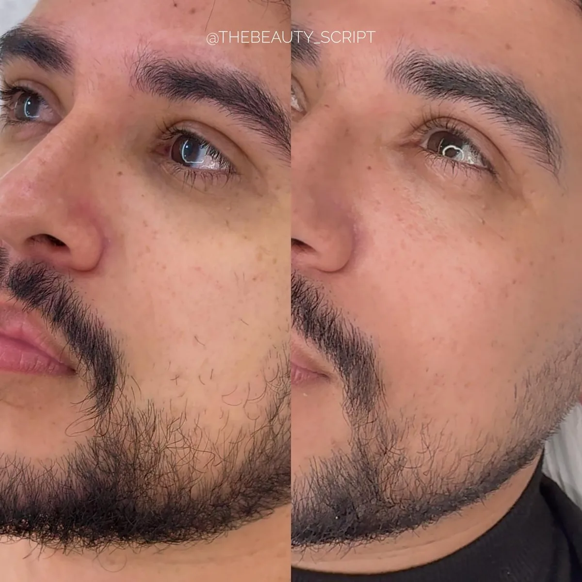 Before and after