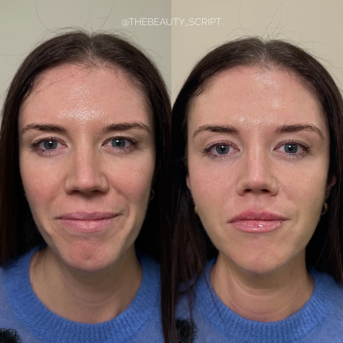 Front — before and after