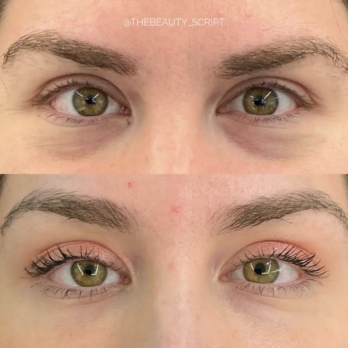 Before and after