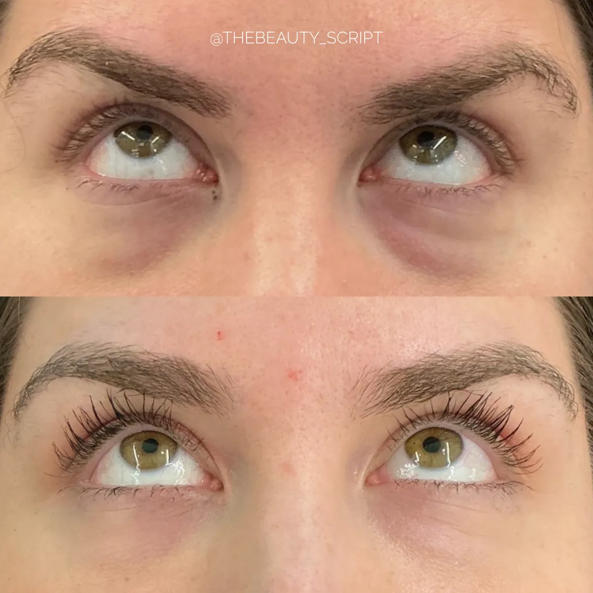 Before and after