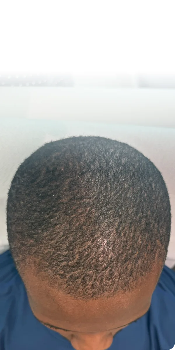 After