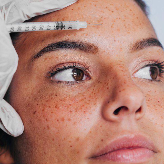 Alluzience Botox Injection