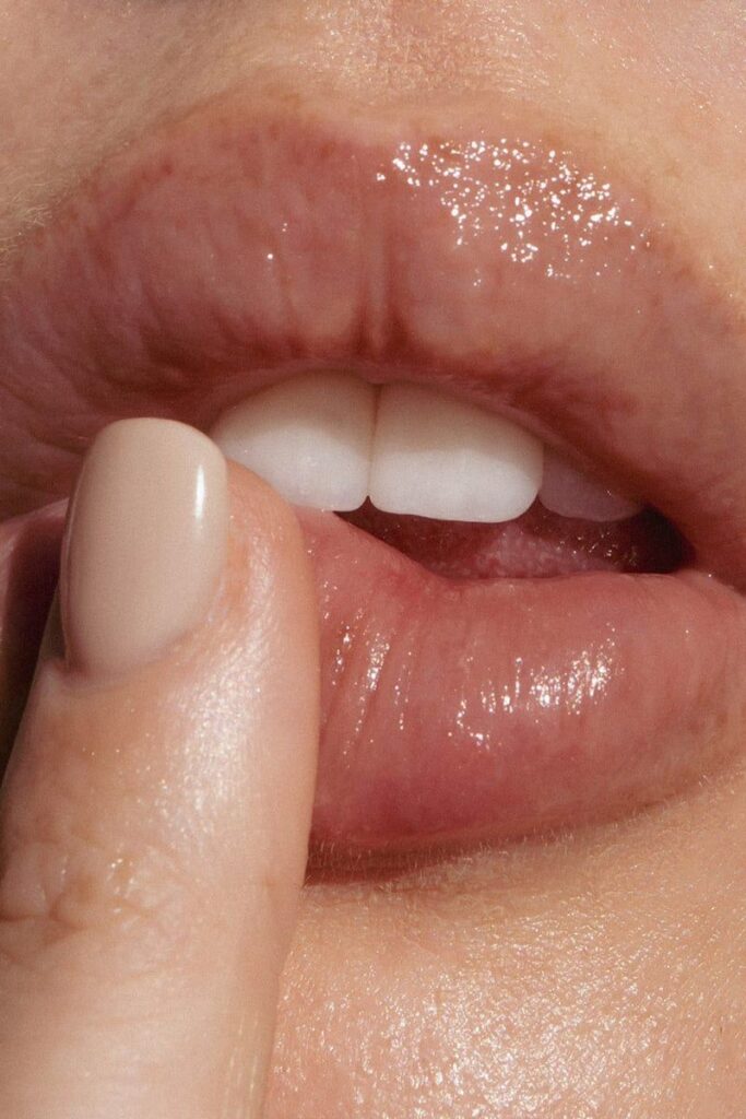 lip filler london treatment
