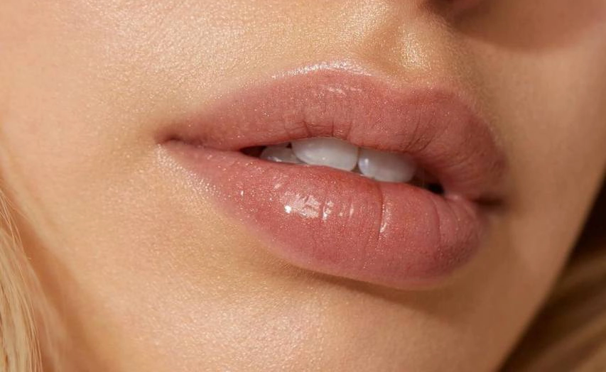 naturally beautifull lips
