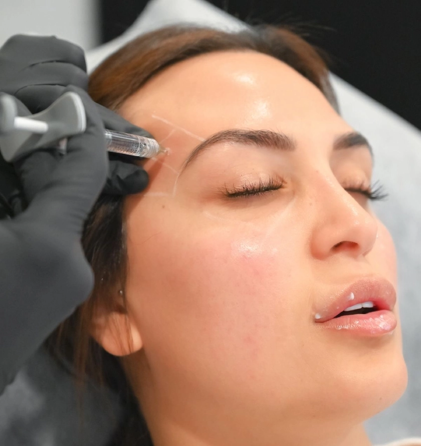 temple filler treatment london