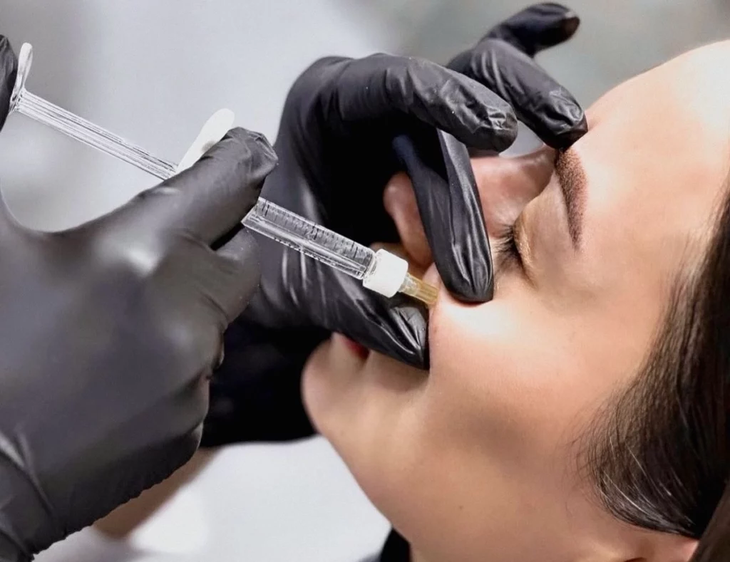 cheek filler treatment london