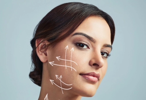 Facelift Filler Treatment