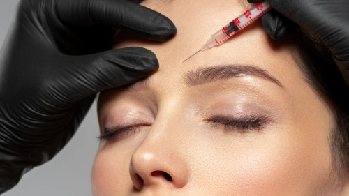 botox Migraine Treatment