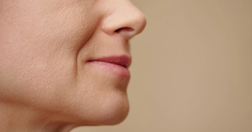 midface