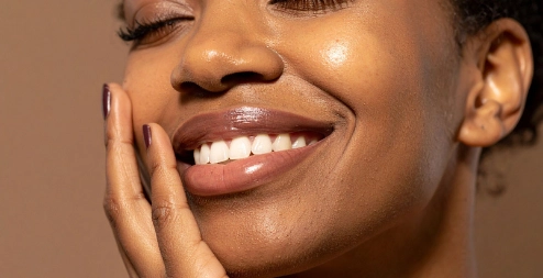 nasolabial folds